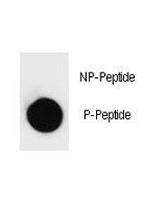 PARP Antibody (phospho-T368)