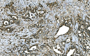RAB13 Antibody