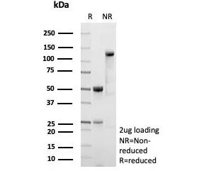 SDS-PAGE analysis of purified, BSA-free recombinant CD54 antibody (clone ICAM1/9379R) as confirmatio