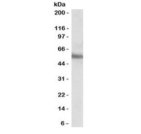 Western blot testing of human MOLT4 cell lysate with ERG antibody at 0.1ug/ml. Predicted molecular w