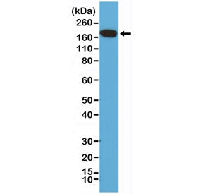 EGF Receptor / EGFR Antibody / C-Terminal