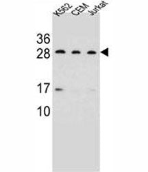 CD79a antibody western blot analysis in K562, CEM, Jurkat lysate. Predicted/Observed molecular weigh