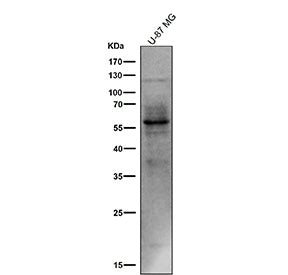 All lanes use the Phospho-Tau (Ser214) antibody at 1:1k dilution for 1 hour at room temperature. The