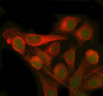 Immunofluorescent staining of PMM2 using anti-PMM2 antibody (green) and anti-Beta Tubulin antibody (