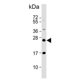 RAB8A Antibody