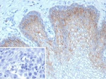 TRIM29 Antibody
