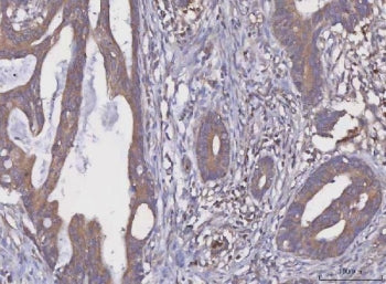 MGAT2 Antibody / Mannoside acetylglucosaminyltransferase 2