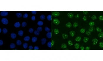 Immunofluorescent staining of FFPE human A431 cells with XRCC1 antibody (green) and DAPI nuclear sta