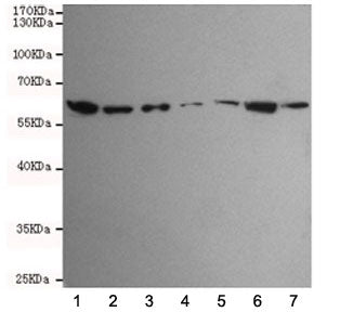 Western blot testing of human 1) HCT116, 2) SW480, 3) HepG2, 4) A549, 5) Jurkat, 6) K562 and 7) HeLa
