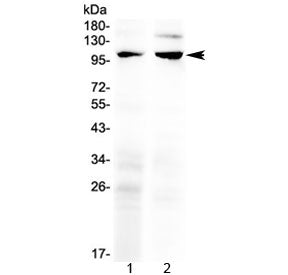 Western blot testing of 1) rat ovary and 2) rat lung lysate with TRPC6 antibody at 0.5ug/ml. Predict