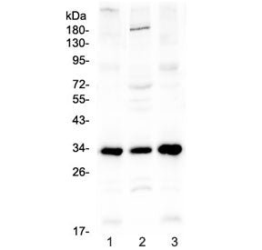 Western blot testing of 1) mouse spleen, 2) mouse testis and 3) rat spleen lysate with MyD88 antibod