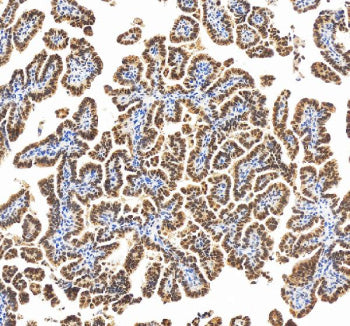 Immunohistochemical staining of RBM17 using anti-RBM17 antibody. RBM17 was detected in a paraffin-em