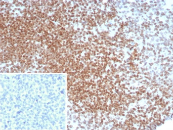 IHC staining of FFPE human seminoma tissue with POU5F1 antibody (clone OCT4/8098R). Inset: PBS used