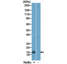 Western blot testing of acid extracts of HeLa cells, treated (+) or untreated (-) with sodium butyra