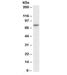 Western blot testing of Jurkat lysate with SLP76 antibody at 0.3ug/ml. Expected molecular weight: ~7