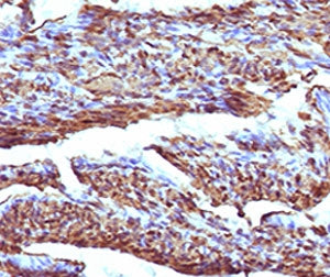 IHC testing of formalin-fixed, paraffin-embedded human uterus stained with recombinant Calponin anti