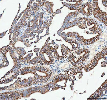 IHC analysis of CAMKK2 using anti-CAMKK2 antibody. CAMKK2 was detected in a paraffin-embedded sectio