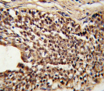 Triosephosphate isomerase Antibody