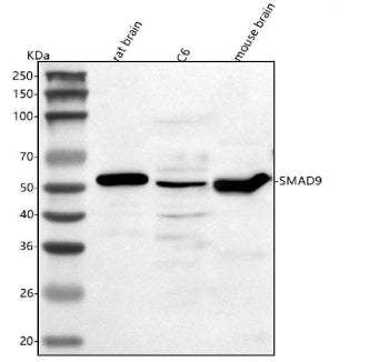 Western blot analysis of Smad9 using anti-Smad9 antibody. Lane 1: rat brain tissue lysates, Lane 2: