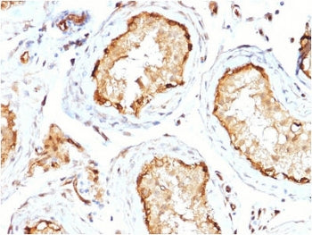 IHC staining of FFPE human testis with 14-3-3 epsilon antibody (clone CPTC-YWHAE-1). HIER: boil tiss