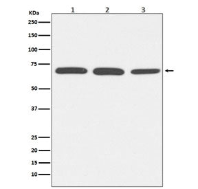 Albumin Antibody / ALB