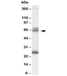 Western blot testing of human brain lysate with GAD65 antibody at 0.1ug/ml. The expected ~65kDa band