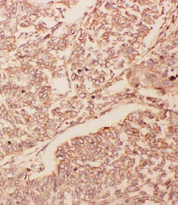 GDNF Antibody