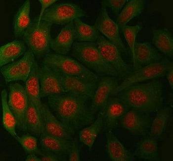 XPA Antibody / DNA repair protein complementing XP-A cells