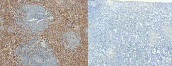 IHC staining of FFPE human spleen tissue with AIF-1 antibody (left) and without AIF-1 antibody (righ