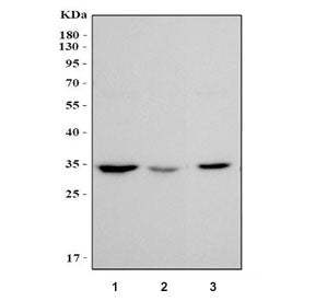 Western blot testing of 1) rat lung, 2) rat stomach and 3) mouse lung tissue lysate with MAPRE1 anti