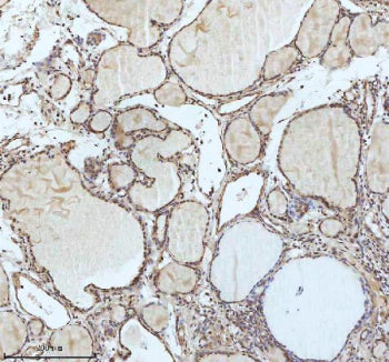 IHC analysis of IRF2BPL using anti-IRF2BPL antibody. IRF2BPL was detected in a paraffin-embedded sec