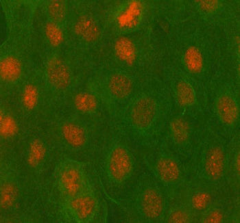 Immunofluorescent staining of PBX4 using anti-PBX4 antibody (red) and anti-Beta Tubulin antibody (gr