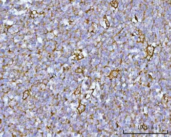 RUFY4 Antibody / RUN and FYVE domain-containing protein 4