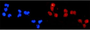 Immunofluorescent staining of FFPE human U-2 OS cells with DDB2 antibody (red) and DAPI nuclear stai
