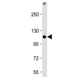 TCIRG1 Antibody (C-Terminal Region)
