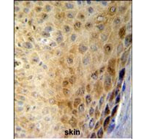 IHC staining of FFPE human skin tissue with GSDMA antibody. HIER: steam section in pH6 citrate buffe