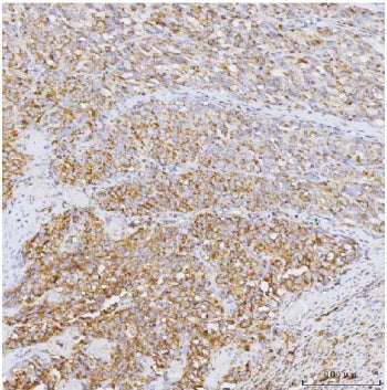 GADD34 Antibody / PPP1R15A