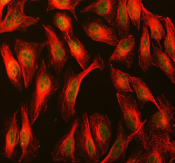 Immunofluorescent staining of MBTD1 using anti-MBTD1 antibody (green) and anti-Beta Tubulin antibody