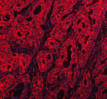 PKP3 Antibody / Plakophilin 3, 100ug