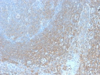 IHC staining of FFPE human tonsil with recombinant Bcl10 antibody (clone BL10/2988R). HIER: boil tis