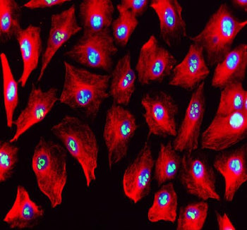 Immunofluorescent analysis of MYBBP1A using anti-MYBBP1A antibody (green) and anti-Beta Tubulin anti