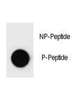 PARP Antibody (phospho-S373)