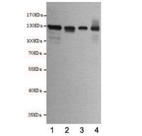 Western blot testing of human 1) T47D, 2) HCT116, 3) MDA-MB-468 and 4) Caco-2 cell lysates using E-C