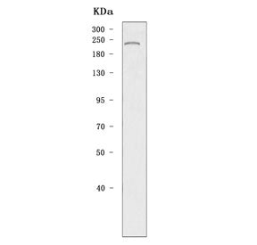 Western blot testing of mouse testis tissue lysate with DNA methyltransferase 1 antibody. Predicted