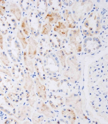 IHC staining of FFPE human kidney tissue with NAT8L antibody. HIER: boil tissue sections in pH 9 10m