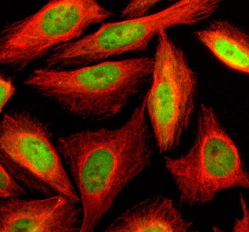 Immunofluorescent staining of SLF2 using anti-SLF2 antibody (green) and anti-Beta Tubulin antibody (