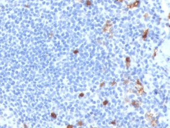 IHC staining of FFPE human tonsil tissue with recombinant IgM antibody (clone MuHC2-2R). HIER: boil