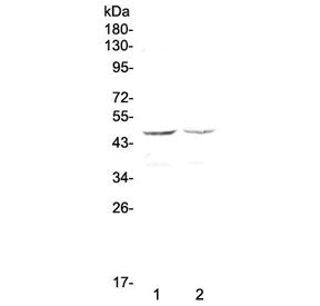 GALT Antibody / Galactose-1-phosphate uridyl transferase