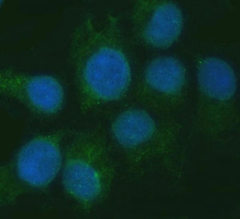 RGS7 Antibody / Regulator of G-protein signaling 7
