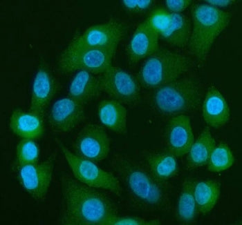 Immunofluorescent staining of FFPE human A549 cells with YAP1 antibody (green) and DAPI nuclear stai